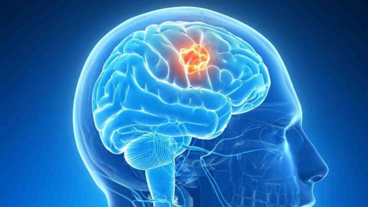 Study discovers crucial step in formation of deadly brain diseases