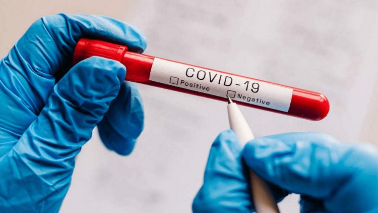 Two arrested for issuing fake COVID-19 negative reports
