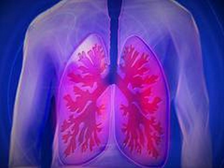 Delaying lung cancer surgery associated with higher risk of recurrence, death: Study
