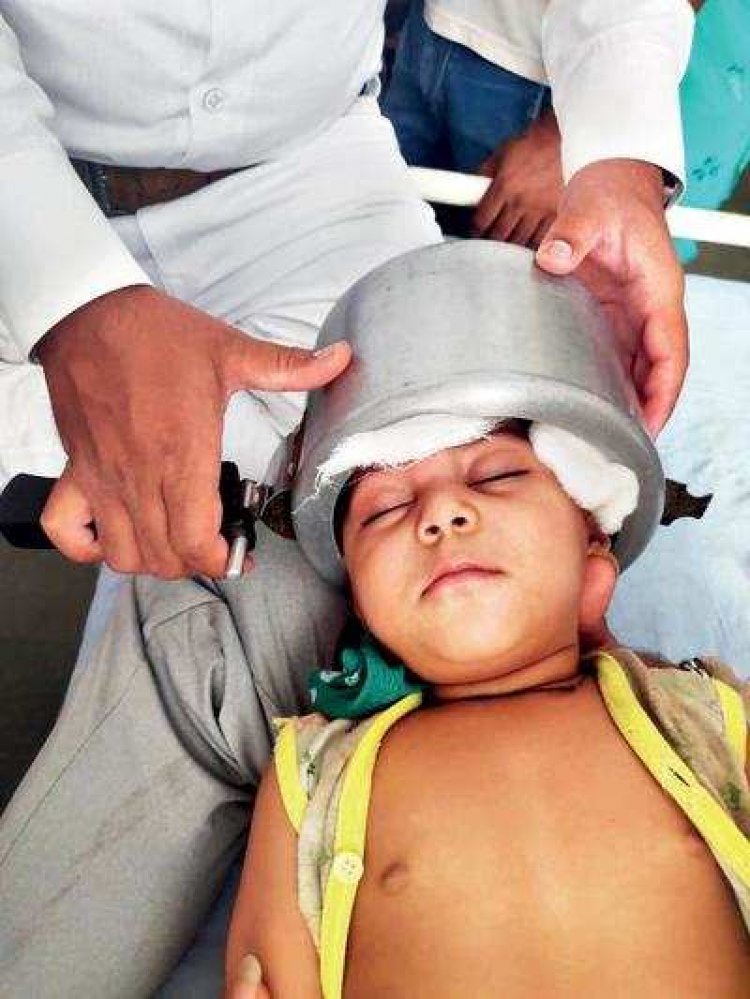 Toddler with head stuck inside pressure cooker freed by doctors in UP's Agra