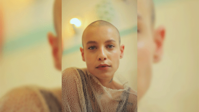 38-Year-Old Woman with Chemotherapy-Induced Hair Loss Gains Her Confidence Back with The Help of QR 678 Therapy treatment