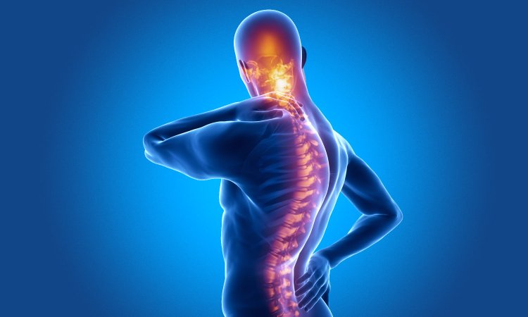 Experts suggest newer and advanced Treatment therapies for Ankylosing Spondylitis