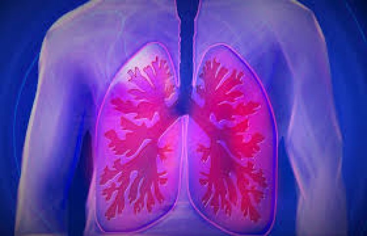 Know Everything About Pulmonary Fibrosis