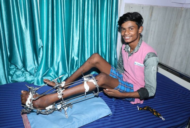 Forming a Life beyond Deformity - overcoming the hurdle of being differently abled with NSS as the saviour