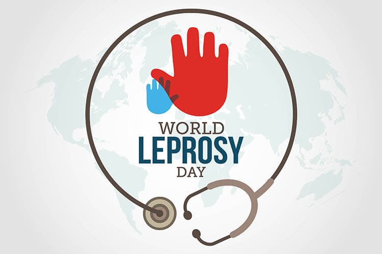 World Leprosy Day: Concrete measures needed to defeat leprosy in Telangana