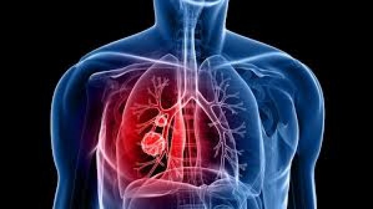 Paper by Manipal College of Pharmaceutical Sciences and University of Kentucky explores new options for diagnosing lung cancer