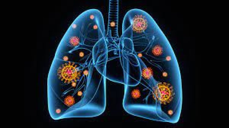 FDA Approves Direct Biologics to Proceed with a Landmark Phase 3 Acute Respiratory Distress Syndrome (ARDS) Trial