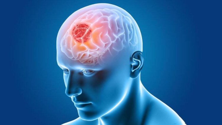 Researchers find new way of treating devastating brain tumours in adults