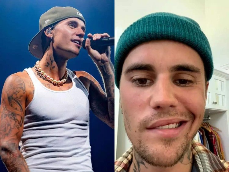 Half of Justin Bieber's face paralyzed by serious virus, cancels shows