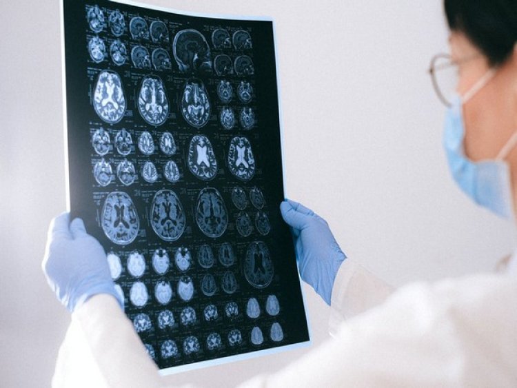Alzheimer's disease can be diagnosed with single brain scan: Research
