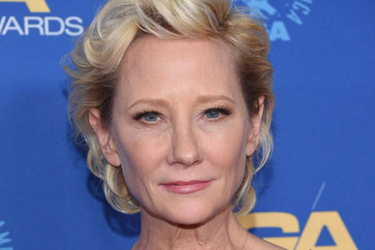 Actress Anne Heche severely burned in car crash