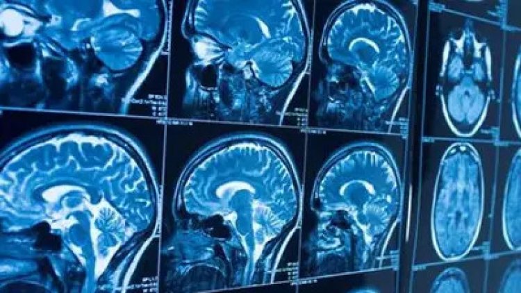 IBS hospital launches brain mapping device, claims it is first of its kind