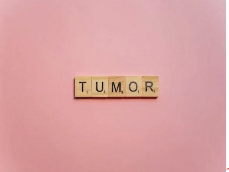 Researchers discover new technologies that give depth understanding of tumors