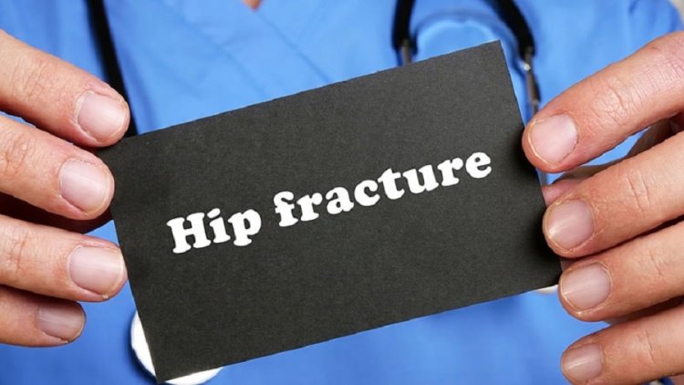 Research: Hip fractures will double worldwide by 2050