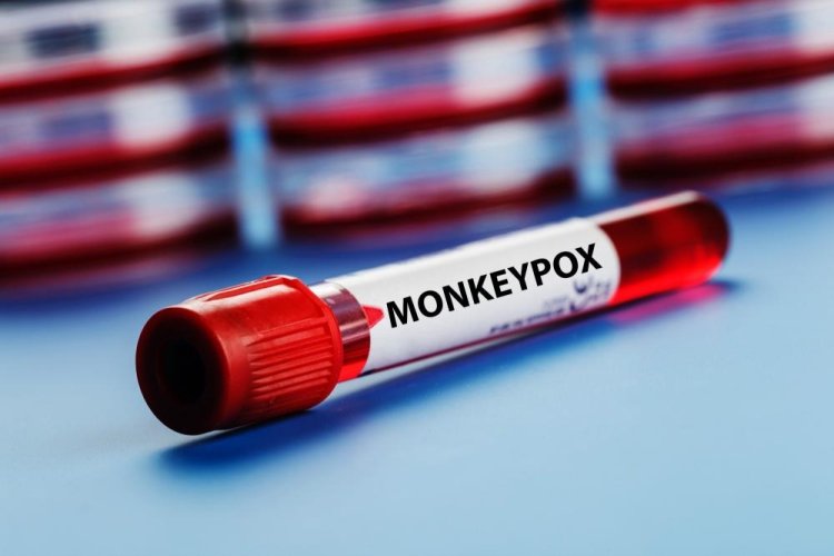 Monkeypox outbreak slowly decreased in US, officials urge caution