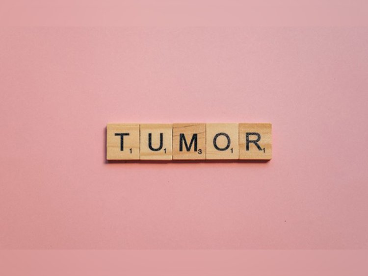Immunotherapy treatments are avoided by tumours by forming temporary structures, finds study