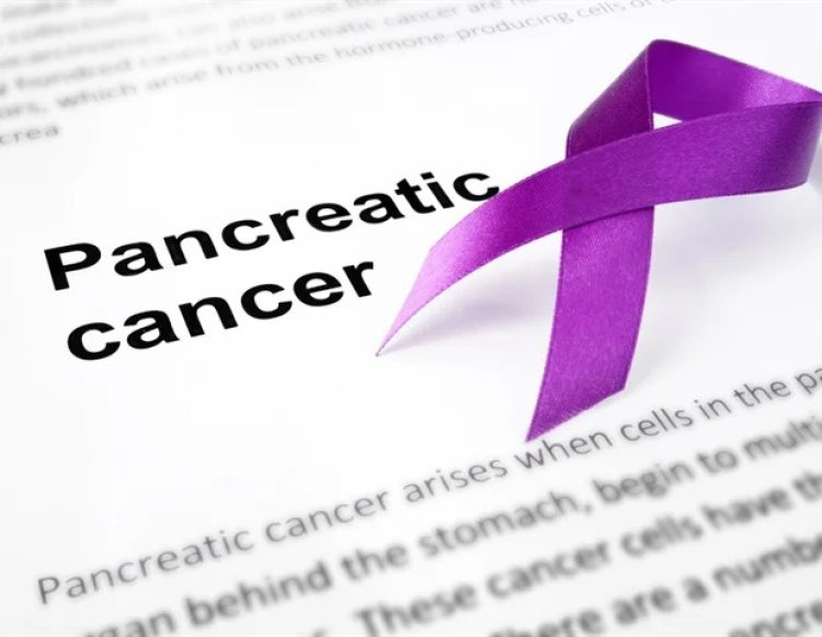 Study reveals four-drug chemotherapy regimens treat metastatic pancreas cancer