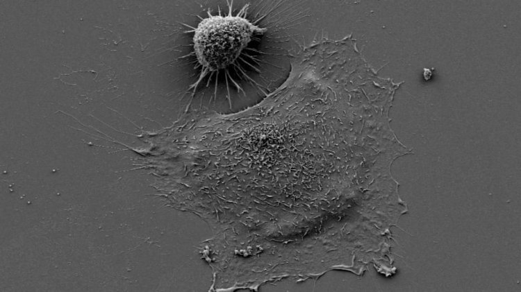 Study reveals cancer cells can alter their size to survive medication