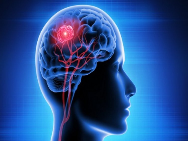 Study finds how brain waves can predict cognitive impairment in Parkinson's disease