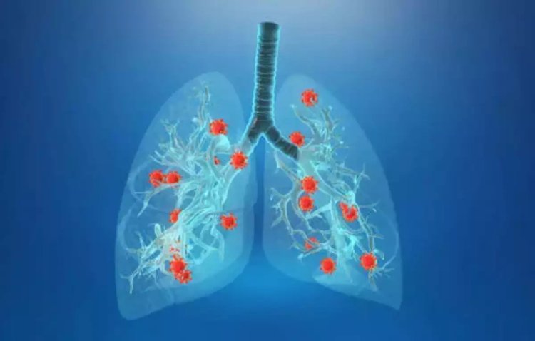 Researchers develop new immunotherapy treatment to target respiratory viral infections