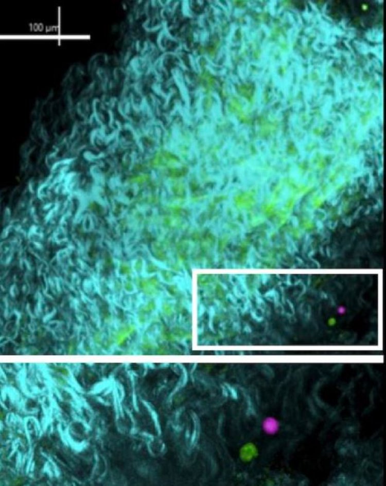 Study reveals when regulatory T cells go bad