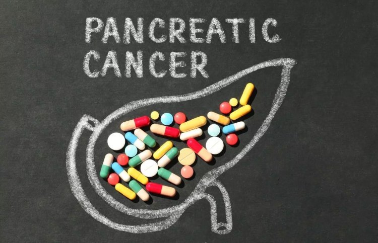 Lorazepam treatment associated with worse outcomes for pancreatic cancer patients: Study