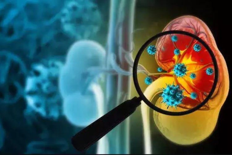 Researchers discover kidney disease gene also has a protective mutation