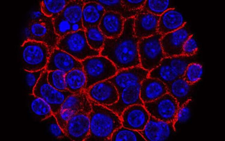 Study finds new ways how pancreatic cancer cells prevent starvation