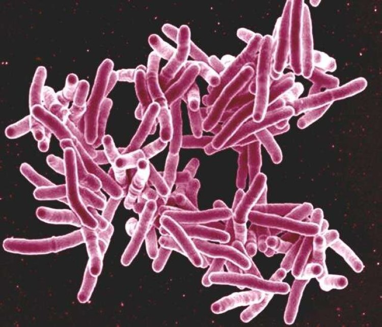 Cord-like aggregates of bacteria cause tuberculosis infections: Study