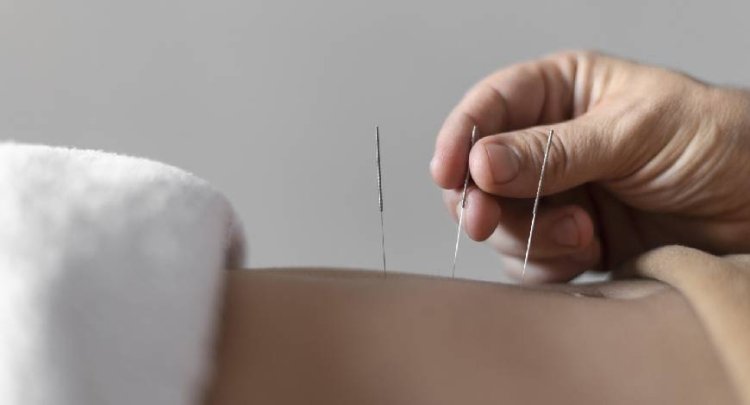 Acupuncture can help mitigate many types of chronic pain: Study
