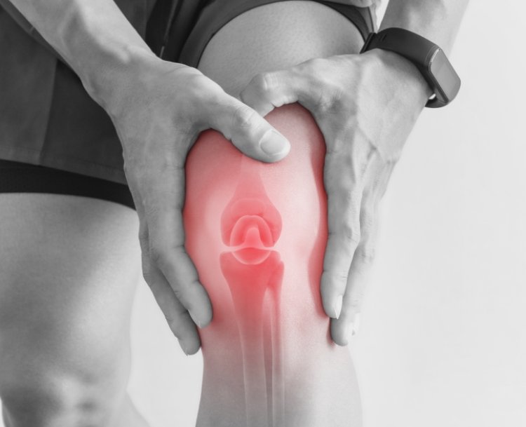 Study finds how stronger quadriceps can prevent knee replacement surgery