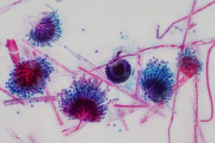 Study gives new insights into fungal infections