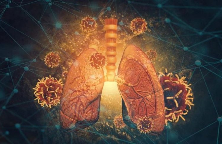 Researchers discover genetic malfunction that causes rare lung disease