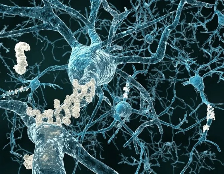 Study finds how mRNA used to target Alzheimer's disease