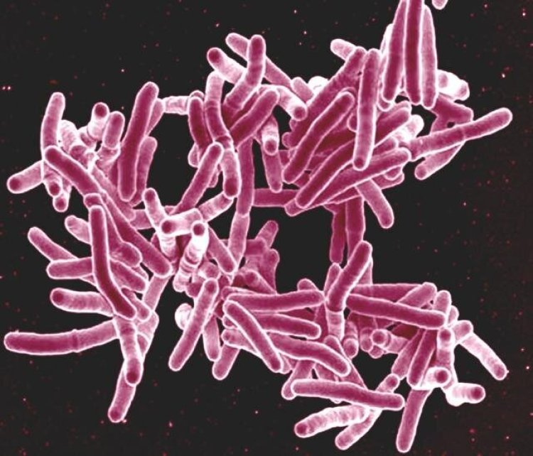 Experts developing immune-enhancing therapies to treat TB: Study