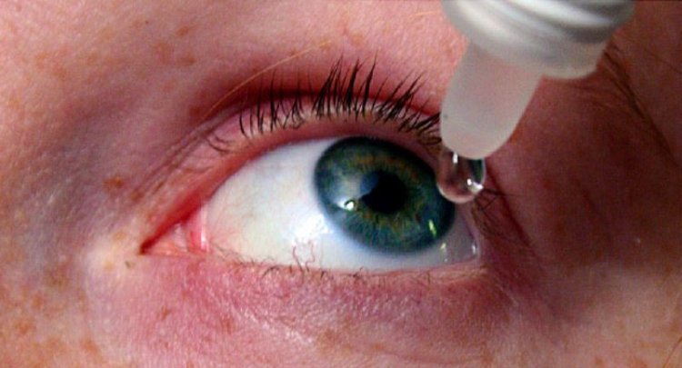 6 Ways To Relieve Dry Eye Syndrome