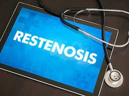 New drug-combination promises prevention of restenosis