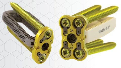 CoreLink Introduces Oro Lateral Plate System Designed for Optimum Versatility to Treat Patients Suffering From Spinal Conditions