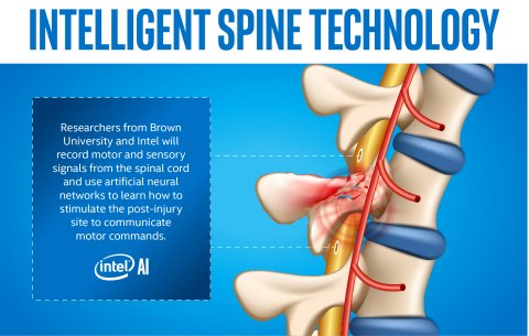 With Hopes of Helping Paralyzed Patients Regain Movement, Intel and Brown University Deploy AI