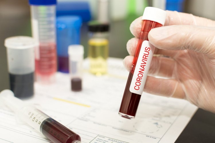 First coronavirus case reported in Andhra Pradesh