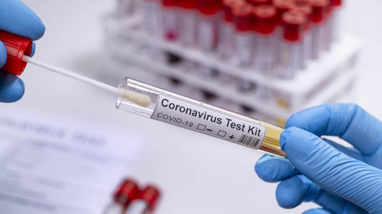 India Panning Out Different Tests to Produce a Solution to the COVID-19 Pandemic