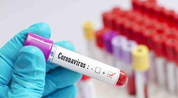 6 more COVID-19 deaths, 254 cases in UP