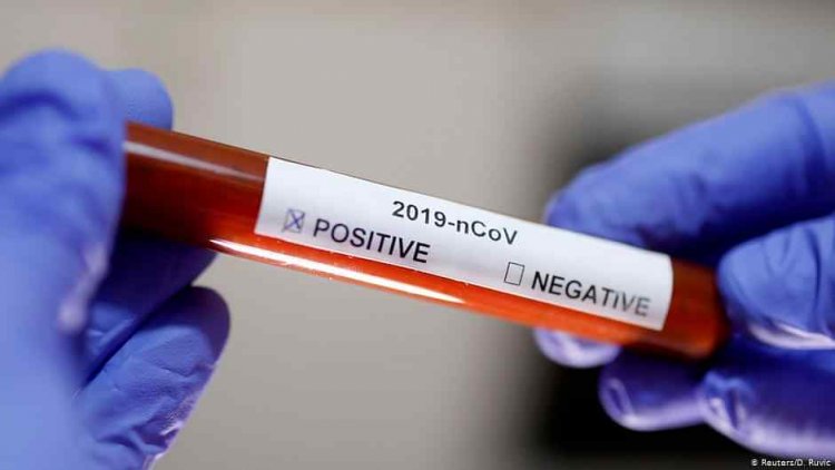 141 more test positive for COVID-19 in Odisha