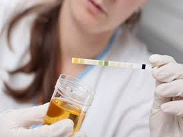 Urine test reveals quality of your diet