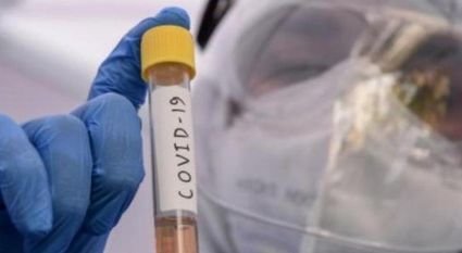 24 more die of coronavirus in UP, toll now 1,108; 1,673 new infections push caseload to 47,036