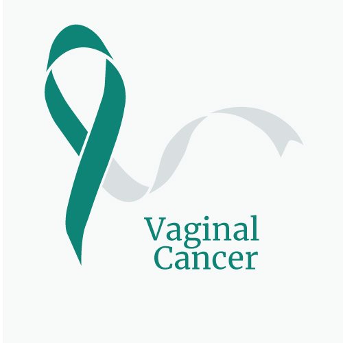Reproductive Health of Women: Vaginal Cancer