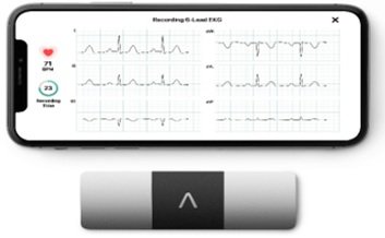 AliveCor Brings World's Only Six-lead, FDA-cleared Personal ECG to India
