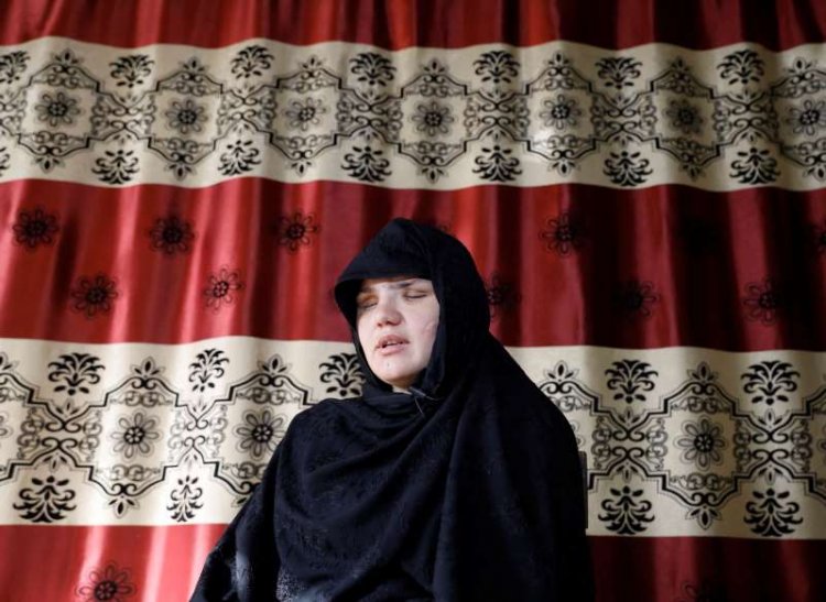 Afghan Woman Shot and Blinded For Getting A Job