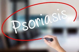 LEO Pharma initiates head-to-head study to evaluate brodalumab vs. guselkumab in adult patients with moderate-to-severe psoriasis who have inadequate response to ustekinumab